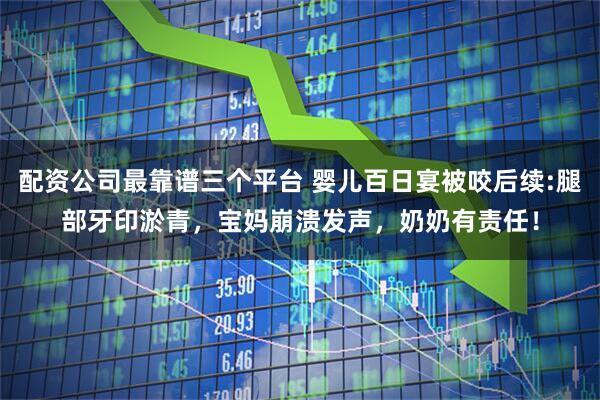 配资公司最靠谱三个平台 婴儿百日宴被咬后续:腿部牙印淤青，宝妈崩溃发声，奶奶有责任！